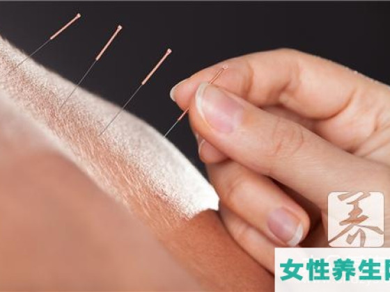 针灸养生竟然会有这些注意事项!