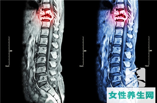艾灸脊柱的好处 