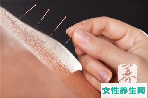 针灸养生竟然会有这些注意事项！